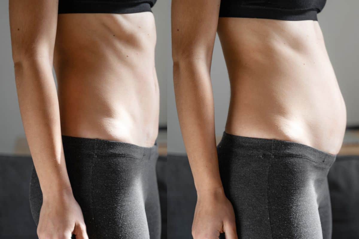 How long does diastasis recti take to improve Barry?