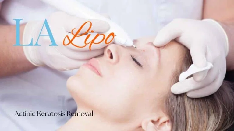 Woman receiving Actinic Keratosis Removal Treatment Barry