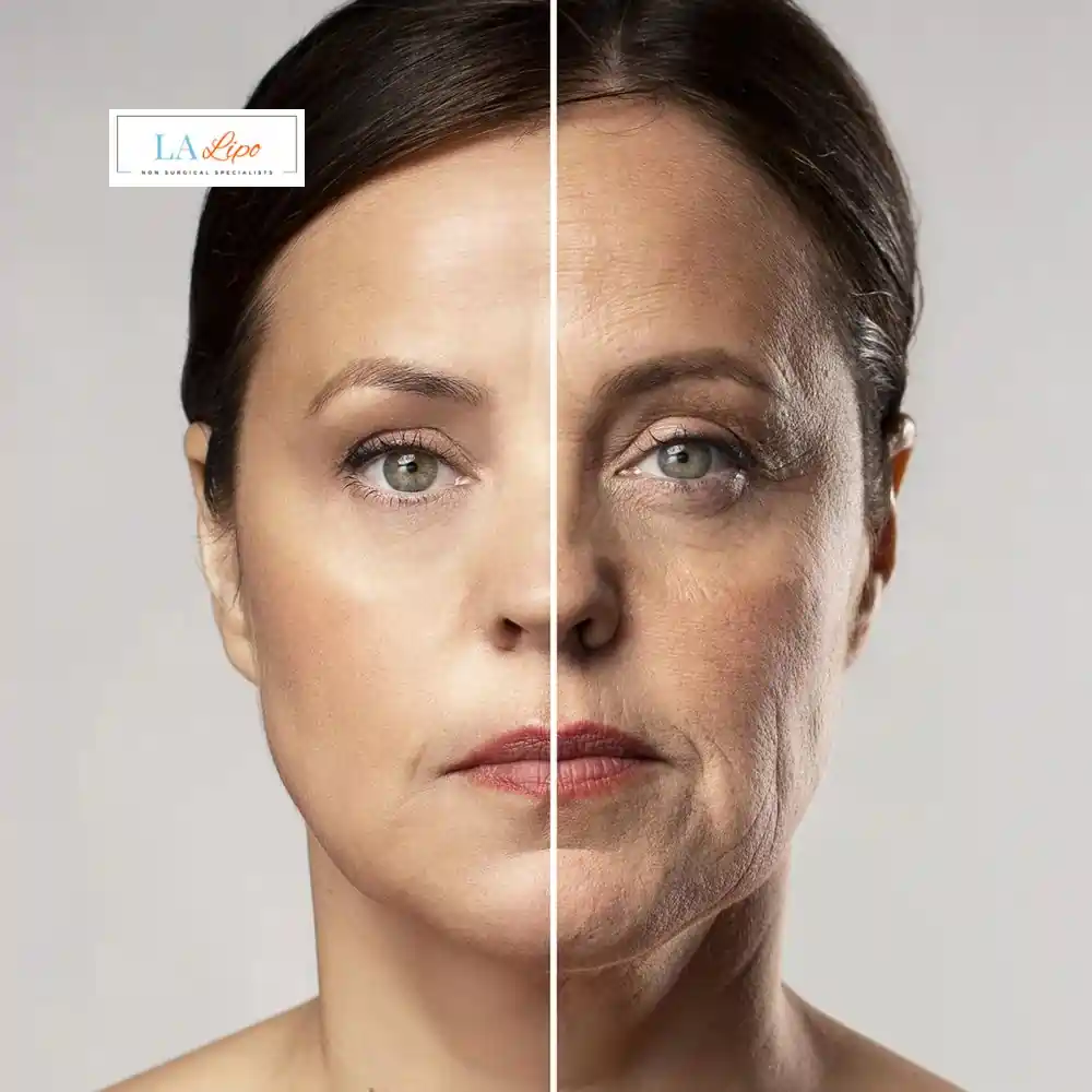 How Can You Tell If Non-Surgical Skin Tightening Is Right for You Barry?