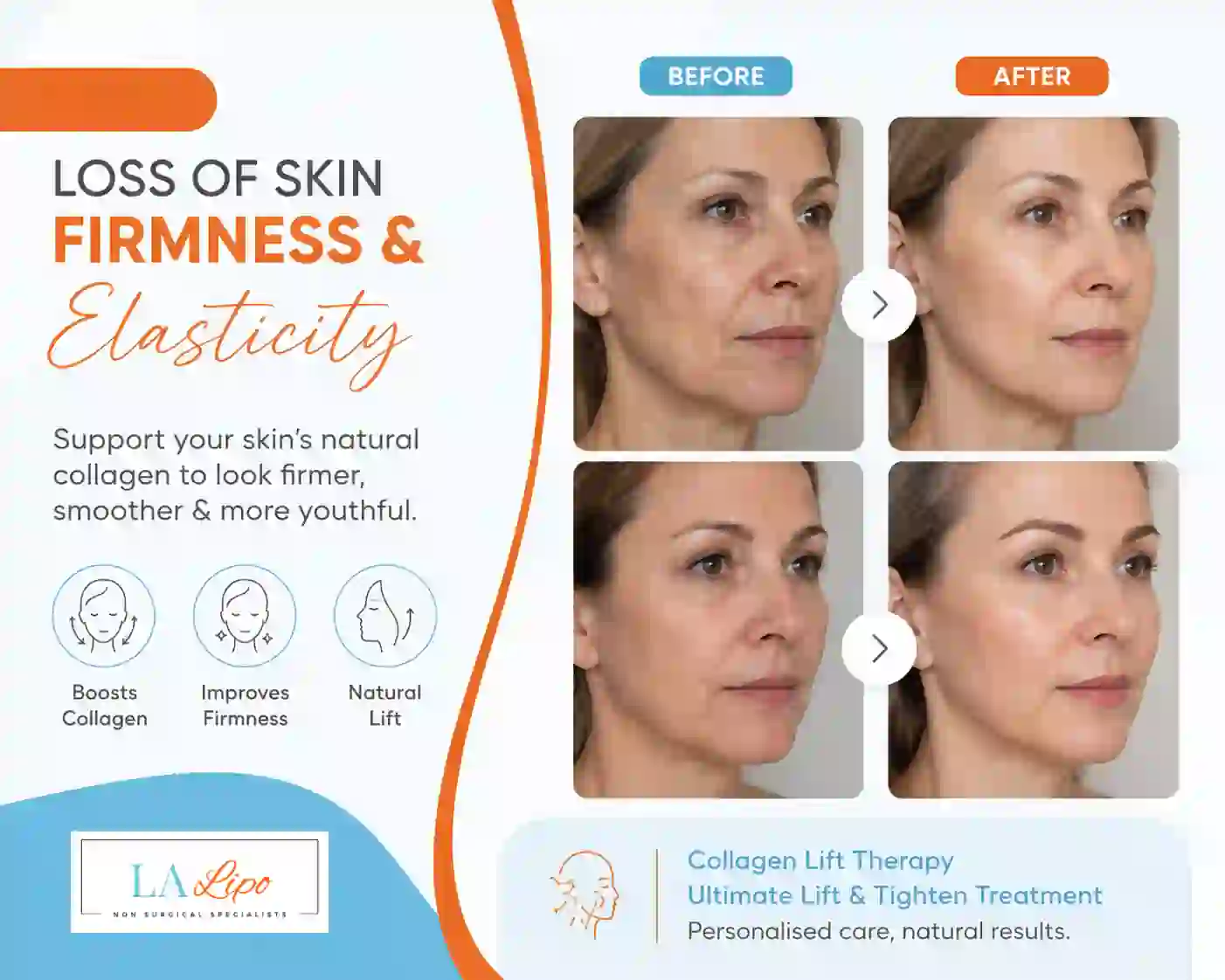Sign #7: Loss of Skin Firmness and Elasticity Barry