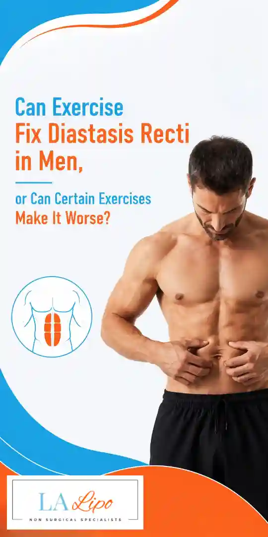 Can Exercise Fix Diastasis Recti in Men, or Can Certain Exercises Make It Worse Barry?
